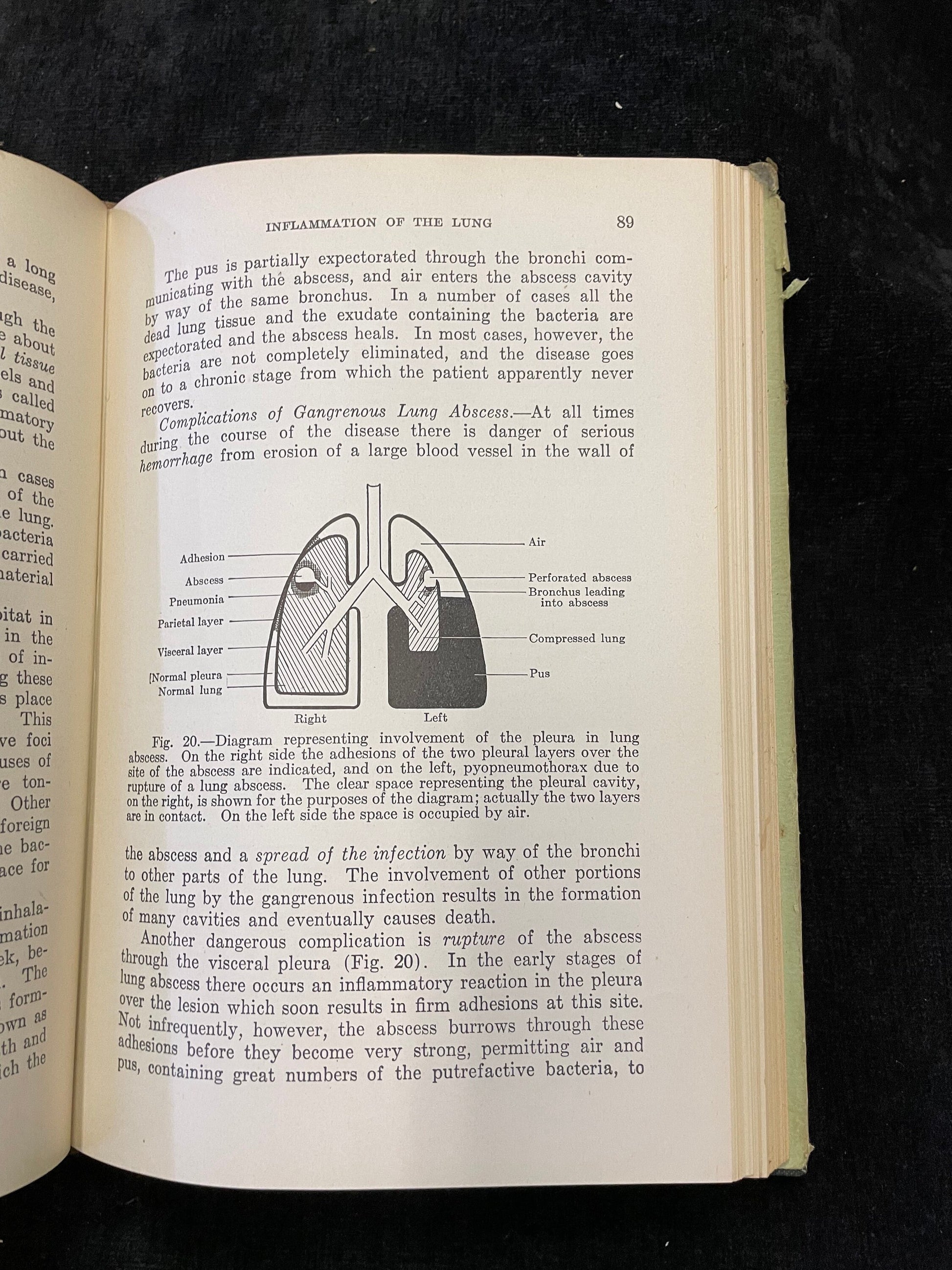 Open book with text and diagrams on a black background
